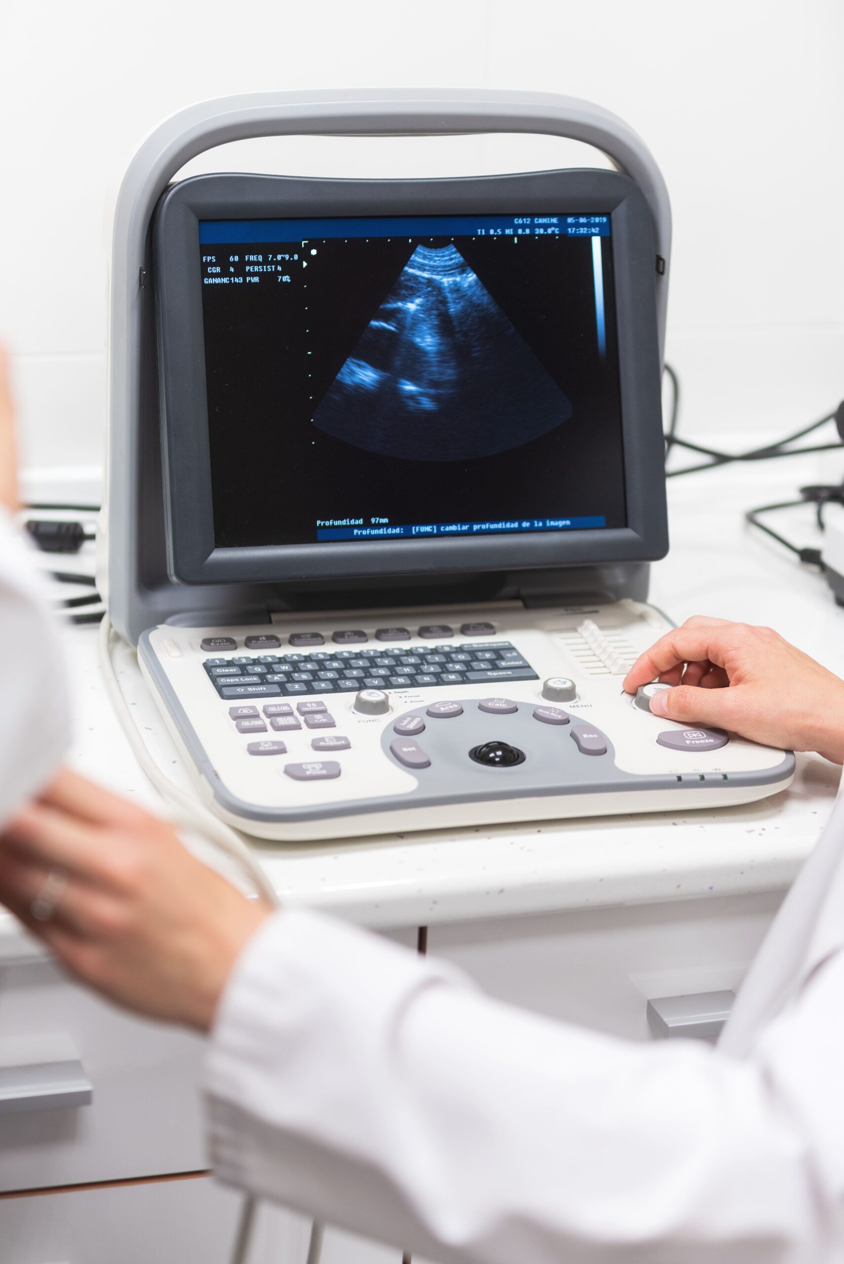 ultrasound-scanner-hands-doctor (1) (1)